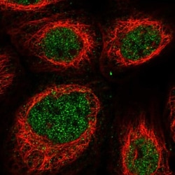 NKX3-2 Antibody, Novus Biologicals 25 &mu;L; Unlabeled:Antibodies, Polyclonal